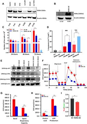 Modulating retinoid-X-receptor alpha (RXRA) expression sensitizes chronic myeloid leukemia cells to imatinib in vitro and reduces disease burden in vivo